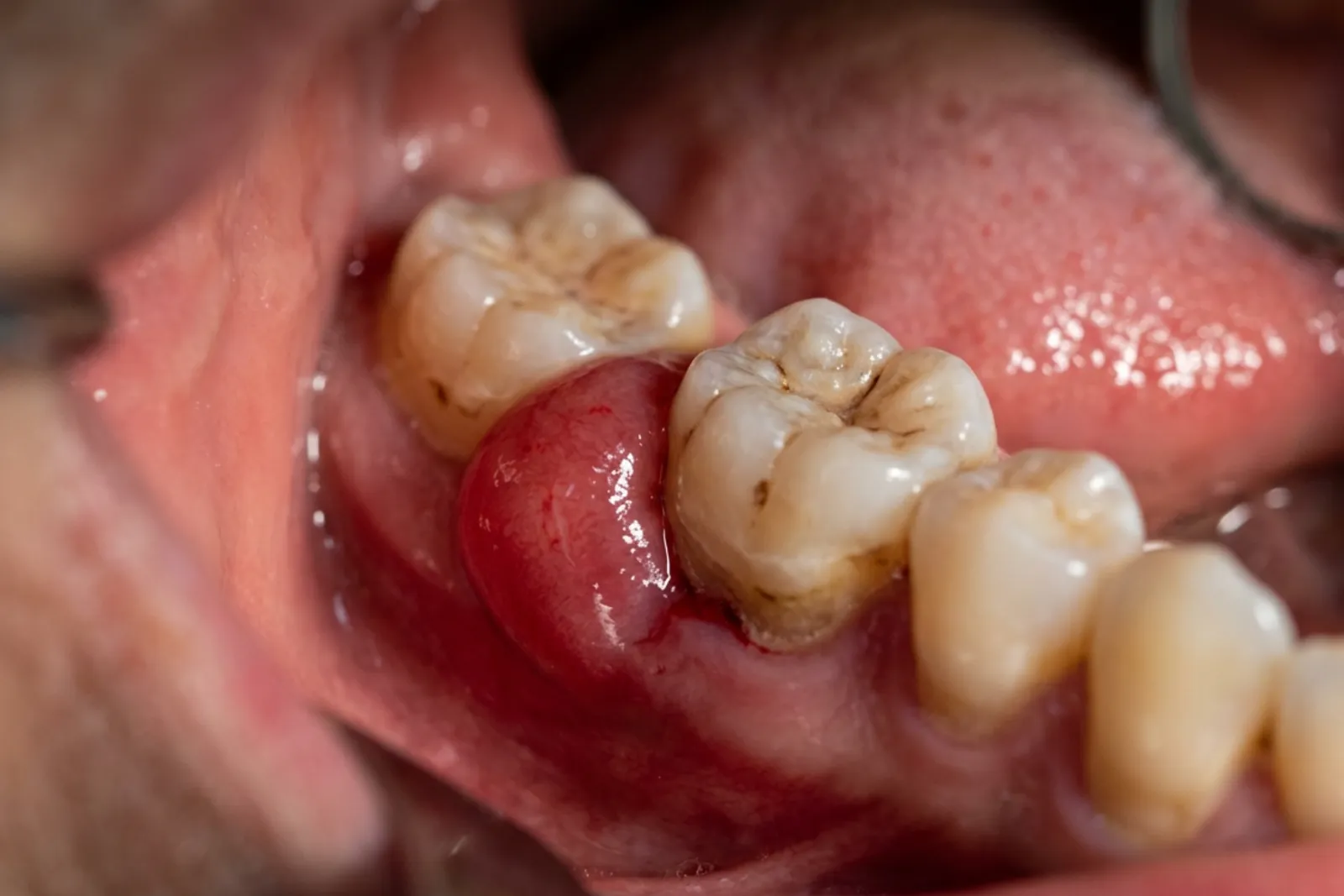 When Tooth Pain Needs Urgent Dental Care