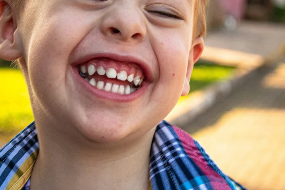 Young child laughing openly, showing healthy baby teeth