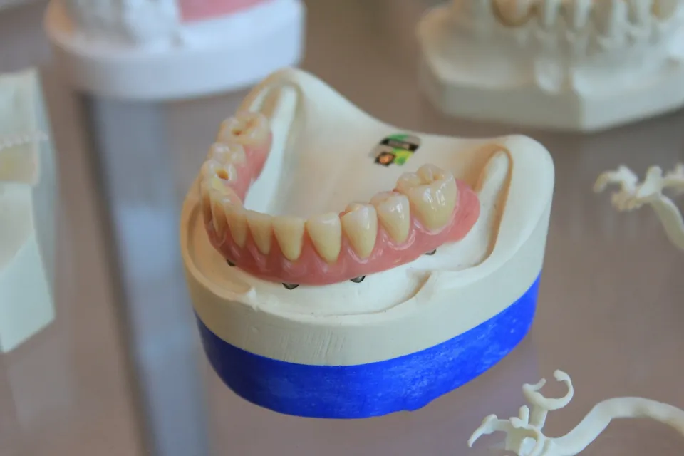 Full acrylic denture with pink gumwork mounted on a dental articulator