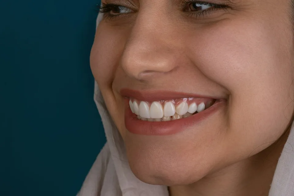 Close-up of a healthy, even gum line framing the upper teeth