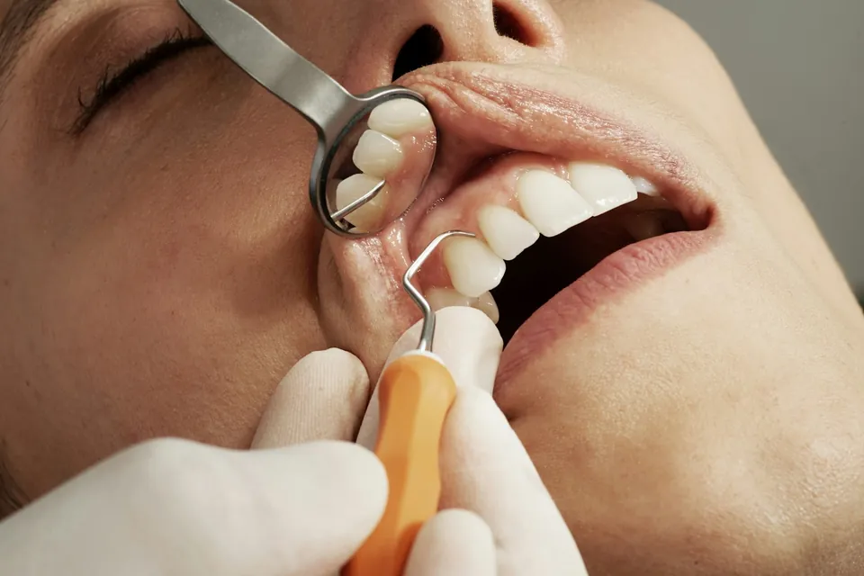 Dentist examining the soft tissues of a patient's mouth with a mirror and probe